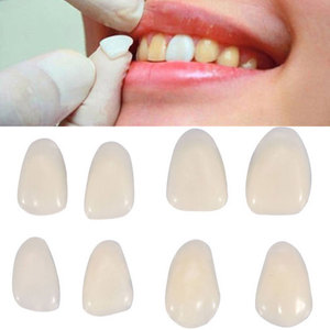 Kit de facettes dentaires personnalisées 50pcs ouvre-dents en résine dentaire d'ombre naturelle pour le blanchiment des prothèses dentaires supérieures/inférieures - Product Image 2