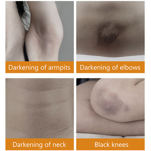 Crème éclaircissante intense pour les parties intimes, <span class=keywords><strong>7</strong></span> <span class=keywords><strong>jours</strong></span>, blanchiment <span class=keywords><strong>rapide</strong></span>, pour éliminer les taches foncées des genoux, des aisselles, de la zone du bikini, des zones intimes - Product Image 5