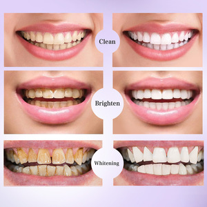 Promotion Exceptionnelle Prix Usine Vente en Gros Blanchiment Dentaire Essence Violette <span class=keywords><strong>Dentifrice</strong></span> <span class=keywords><strong>Violet</strong></span> - Product Image 6