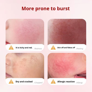 Crema Hidratante para Niños Personalizada OEM, Crema Facial Hidratante de <span class=keywords><strong>Aloe</strong></span> <span class=keywords><strong>Vera</strong></span> Anti-Grietas para Bebés, Cuidado de la Piel para Niños en Otoño e Invierno - Product Image 2