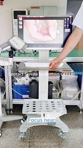 Çekirdek tam <span class=keywords><strong>HD</strong></span> <span class=keywords><strong>video</strong></span> kolposkop jinekoloji vajina muayene endoskop dijital <span class=keywords><strong>Video</strong></span> kolposkop için vajinal kamera - Product Image 6