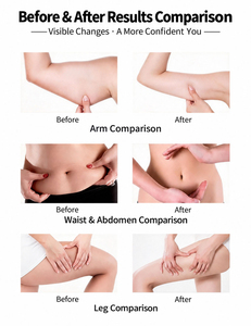 Nouvel arrivage : Appareil de massage corporel amincissant pour l'abdomen, les jambes, les épaules, le cou – Dispositif de relaxation corporelle - Product Image 2