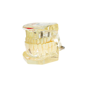 Modèles de prothèses dentaires, modèles dentaires détachables, modèles de restauration d'implants, enseignement intuitif. - Product Image 2