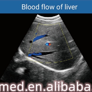 Appareil d'échographie cardiaque EO-C50, scanner d'échographie Doppler couleur portable, appareil de diagnostic ultrasonore avec batterie intégrée - Product Image 6