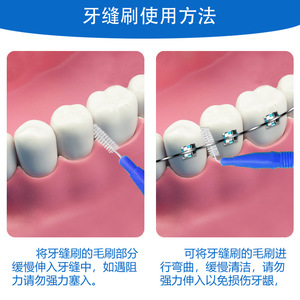 แปรงซอกฟัน ขนแปรงสแตนเลส ด้ามพลาสติก ทำความสะอาดช่องปาก บรรจุ 10 ชิ้น ใช้ทั่วไป - Product Image 2