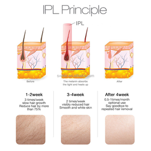 Equipo de Belleza Multifuncional Portátil con <span class=keywords><strong>2</strong></span> Manijas para Depilación, Eliminación de Pigmentación y Blanqueamiento de la Piel - Product Image 6