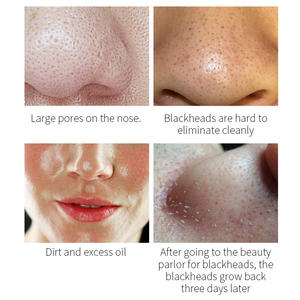 Siero OEM 30ML con <span class=keywords><strong>Acido</strong></span> <span class=keywords><strong>TCA</strong></span> Naturale per Resurfacing Cutaneo, Riduzione dei Pori, Rimozione dei Punti Neri e Miglioramento della Luminosità per la Cura Quotidiana del <span class=keywords><strong>Viso</strong></span> - Product Image 5