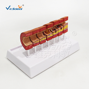 Modelo de <span class=keywords><strong>Arteriosclerosis</strong></span> con Tarjeta de Instrucciones, Modelo Anatómico de Lesiones Vasculares para <span class=keywords><strong>la</strong></span> Educación sobre <span class=keywords><strong>la</strong></span> Salud Cardiovascular - Product Image 4