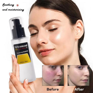 Produits de soins de <span class=keywords><strong>la</strong></span> <span class=keywords><strong>peau</strong></span> sérum facial anti-acné escargot OEM anti-âge élimination des <span class=keywords><strong>taches</strong></span> brunes sérum hydratant réparateur pour le visage - Product Image 5