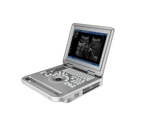 Appareil d'échographie vétérinaire portable noir et blanc de haute qualité, échographie vétérinaire, échographie pour animaux de compagnie - Product Image 1