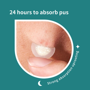 Tambalan penutup noda jerawat, tambalan tidak terlihat jerawat wajah - Product Image 5