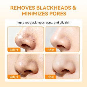 LANBENA <b>Nose</b> Care Blackhead Removal <b>Nose</b> Mask Deep Cleansing <b>Witch</b> Hazel <b>Nose</b> Strips for Skin Pores Shrinking - Product Image 3