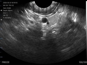 Ecógrafo Inalámbrico Pequeño de Doble Sonda para Escaneo Abdominal Completo, Histeroscopia y Bolsa <span class=keywords><strong>Fetal</strong></span>, Multiusos - Product Image 5