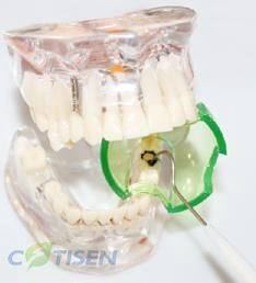 Alat Traktor Mulut Silikon Habis Pakai Dental, Pelindung Lidah Ortodontik untuk Tabung Sistem Bidang Kering - Product Image 4