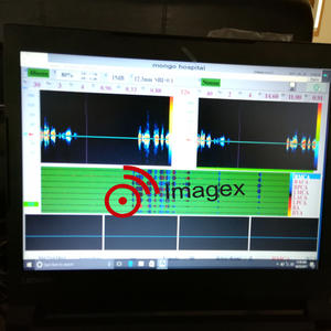 Het Beste Diagnostische Transcraniële Dopplersysteem Voor Tcd-Testmachines Met 2Mhz 4Mhz-Sondes Voor Het Testen Van De Hersenstroom - Product Image 4