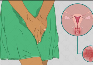 Di alta qualità 980nm 1470nm macchina di serraggio vaginale portatile luce rossa dispositivo di terapia per uso domestico CE approvazione UK/EU Plug - Product Image 4