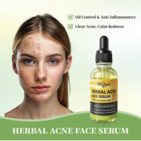 Sérum Visage Traitant l'Acné à Base de Plantes, Huile Essentielle Naturelle Anti-Boutons et Anti-Imperfections pour Peaux Grasses, Réparation des Pores