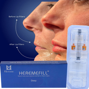Relleno Labial <span class=keywords><strong>de</strong></span> Ácido Hialurónico Biofermentado <span class=keywords><strong>de</strong></span> Alta Pureza, Gel HA Reticulado <span class=keywords><strong>para</strong></span> <span class=keywords><strong>Aumento</strong></span> Labial <span class=keywords><strong>de</strong></span> Larga Duración, Aprobado por la CE - Product Image 1