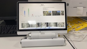 Tricoscopio Inteligente con IA 2026, Cámara UV para Análisis de Folículos Capilares, Dispositivo de Belleza para Análisis de Cabello y Cuero Cabelludo - Product Image 6