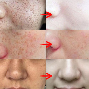 Отбеливающий крем для лица - Product Image 6