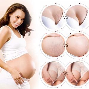 <span class=keywords><strong>Crema</strong></span> <span class=keywords><strong>per</strong></span> la riparazione della cicatrice della gravidanza con etichetta privata lozione biologica <span class=keywords><strong>per</strong></span> il trattamento del corpo smagliature - Product Image 5