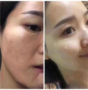 Crème Visage Éclaircissante <span class=keywords><strong>Rapide</strong></span> <span class=keywords><strong>7</strong></span> <span class=keywords><strong>Jours</strong></span> à l'Astragale, Raffermissante et Anti-Taches - Product Image 2