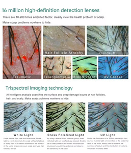 เครื่องดูแลหนังศีรษะขายดีที่สุด ช่วยกำจัดรูขุมขนอักเสบ ลด<span class=keywords><strong>รังแค</strong></span> ปรับปรุงปัญหาผมมัน พร้อมเครื่องวิเคราะห์สภาพเส้นผม - Product Image 3