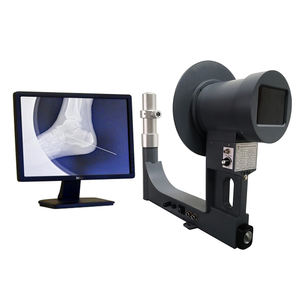 Máquina portátil da fluoroscopia do raio <span class=keywords><strong>X</strong></span> do equipamento do instrumento da fluoroscopia do raio <span class=keywords><strong>X</strong></span> de JZXR com bateria recarregável <span class=keywords><strong>X</strong></span> <span class=keywords><strong>Ray</strong></span> máquina - Product Image 2