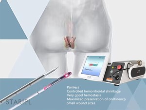 Laser 980nm 1470nm per le emorroidi polipi e fessure anali Hemostasis taglio Laser di coagulazione - Product Image 3