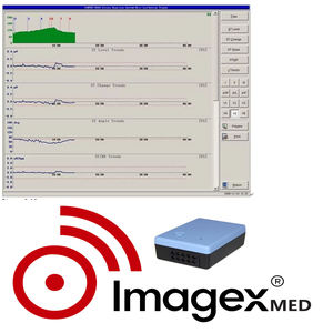 Sistema de ECG Inalámbrico de 12 Derivaciones, Máquina de ECG de Esfuerzo para Diagnóstico de Cardiología Veterinaria - Product Image 6