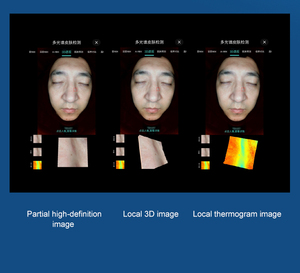 Analizador de Piel Digital 3D en Oferta, Espejo Mágico con Escáner Facial, Detección con Inteligencia Artificial, Conexión WiFi, para Uso Comercial - Product Image 3