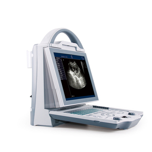 Hoge Kwaliteit 10.4 Inch Led Scherm Oogheelkundige Echografie A/B <span class=keywords><strong>Scan</strong></span> Lage Prijs - Product Image 3