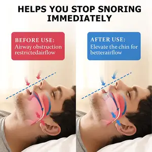 Pelindung mulut Anti dengkuran, perangkat Anti dengkuran nyaman untuk tidur di malam hari