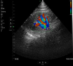 Tragbare drahtlose 2-in-1-Ultraschallsonde mit linearem Hochleistungs-Phased-Array für den klinischen Einsatz - Product Image 6