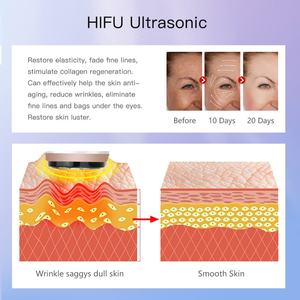 Appareil de beauté multifonctionnel RF pour la maison, soins personnels, soins de la peau, anti-rides, lifting, raffermissement des yeux, masseur facial - Product Image 4