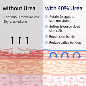 Crema Exfoliante para Pies de Marca Privada, Loción Corporal Hidratante para Grietas, Crema Reparadora para Pies con Urea Blanqueadora - Product Image 5