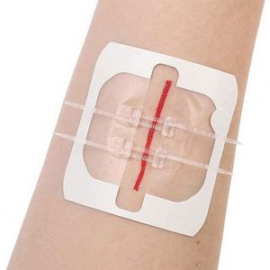 China Factory Multi-Color Water-Resistant 2.5-10Cm Size Kinesiology <b>Tape</b> - Product Image 2