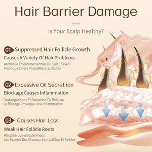 Productos orgánicos personalizados <span class=keywords><strong>para</strong></span> el crecimiento del cabello <span class=keywords><strong>para</strong></span> la piel negra, <span class=keywords><strong>champú</strong></span> <span class=keywords><strong>para</strong></span> la cabeza calva, suero <span class=keywords><strong>para</strong></span> el cuidado del cuero cabelludo, juego de <span class=keywords><strong>champú</strong></span> <span class=keywords><strong>para</strong></span> el crecimiento del cabello y anticaída - Product Image 6