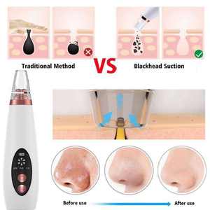 Limpiador de Poros por Vacío Eléctrico Facial Más Vendido Kit para Eliminar Acné y Limpieza Facial Removedor de Puntos Negros - Product Image 2