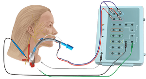Tubo Endotraqueal para Monitoreo Nervioso (ET) en Cirugía de Tiroides y Paratiroide con Monitoreo EMG - Product Image 3