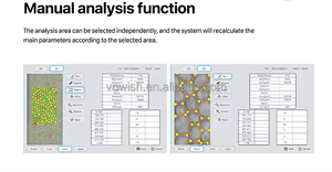 Microscopio especular corneal <span class=keywords><strong>de</strong></span> Oftalmología Microscopio especular corneal médico SW-7000 - Product Image 4