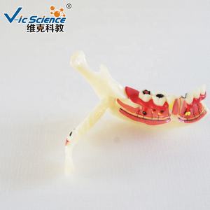 Modelo Dental Anatómico de Dientes Posteriores Inferiores Derechos en Resina y PVC para Educación en Ciencias Médicas en Escuelas y Hospitales - Product Image 4