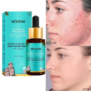 Suero Antiacné de Ácido Salicílico + Ácido Glicólico de Marca Privada de 30 ml - Product Image 3