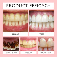 Vente en gros de dentifrice blanchissant Cotelg 120g SP 6, style doux, nettoyage en douceur, haleine fraîche et élimination quotidienne des taches, sourire sain et éclatant