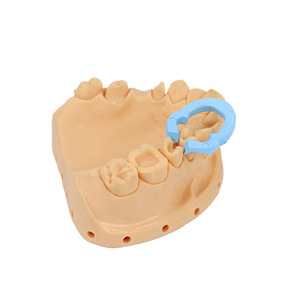 Pinces de fixation en caoutchouc dentaire, anneaux de retenue en résine, 4 pièces, résistantes aux hautes températures, pour chirurgie dentaire - Product Image 3
