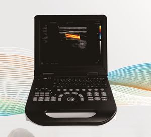 Ecógrafo Doppler Color Portátil GCP-E30, Escáner Médico Humano para Abdomen, Obstetricia/Ginecología, Cardiología, Vascular, Órganos Pequeños - Product Image 1