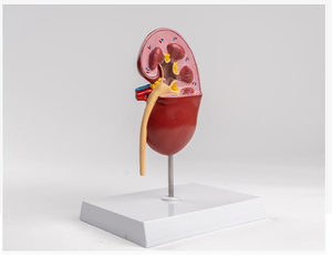 Modelo de Riñón Patológico, Modelo Anatómico Humano para Enseñanza Médica, Demostración de Nefritis, <span class=keywords><strong>Urología</strong></span> Renal, Hospital - Product Image 2