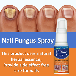 Soins des pieds, herbes naturelles chinoises, 30 ml, meilleur traitement pour les infections fongiques des ongles des pieds et réparation des ongles fongiques - Product Image 3