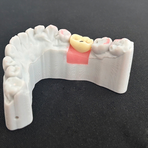 Prothèses dentaires pour implants dentaires Couronnes en zircone à vis <span class=keywords><strong>molaire</strong></span> unique Prix bon marché pour laboratoires et cliniques dentaires - Product Image 4