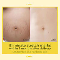 Huile nourrissante à la vitamine E pour éliminer les vergetures, sérum réparateur des cicatrices post-partum, essence lissante pour le corps, soin des peaux sèches et de la cellulite